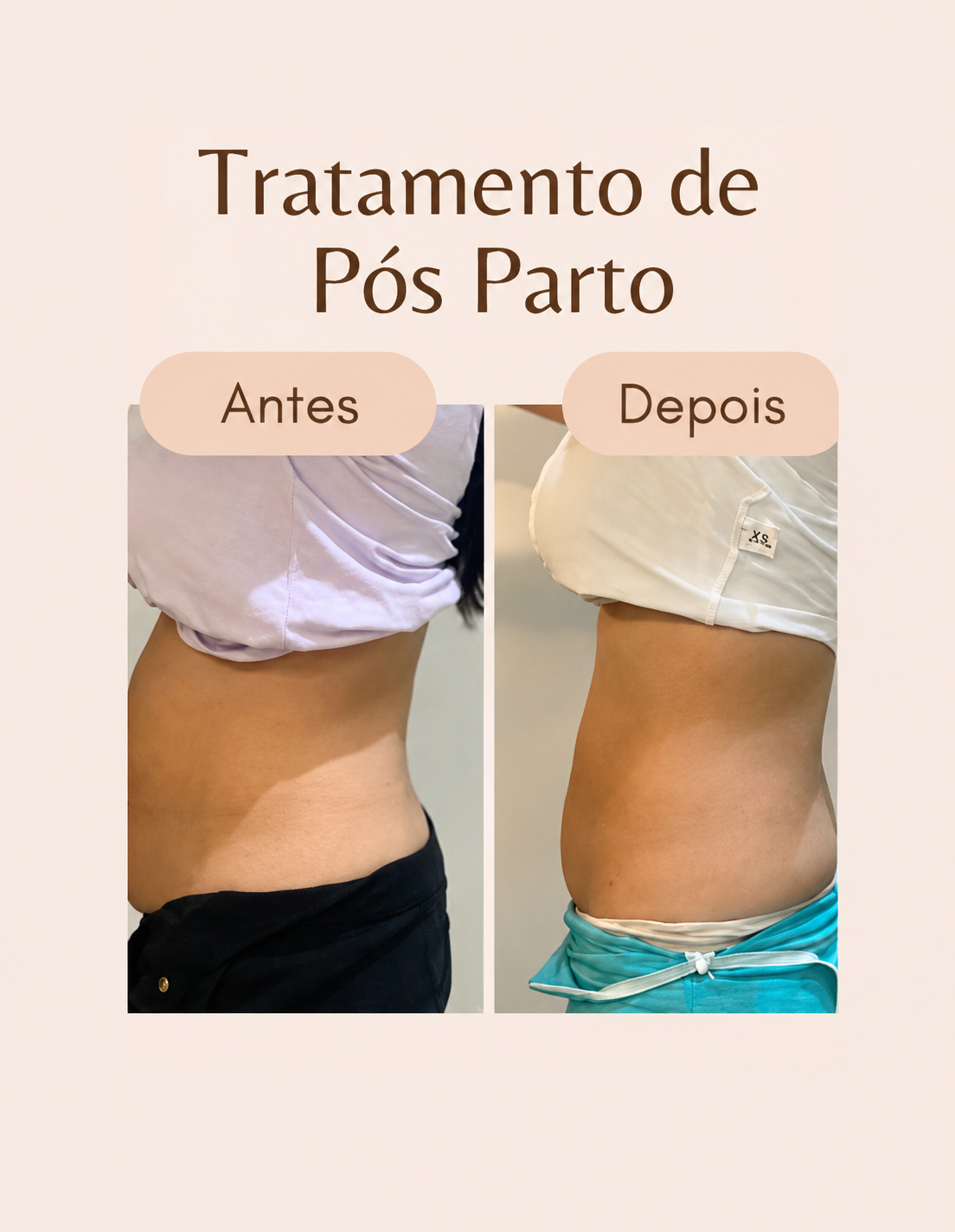Antes e depois do tratamento pós-parto 1