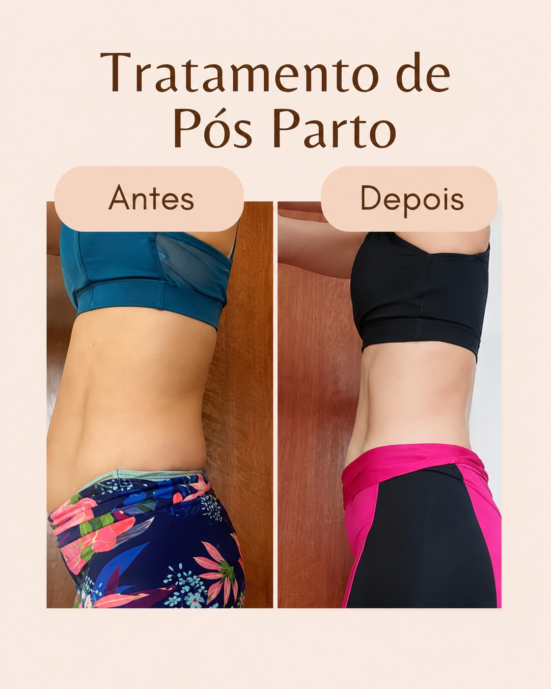 Antes e depois do tratamento pós-parto 3